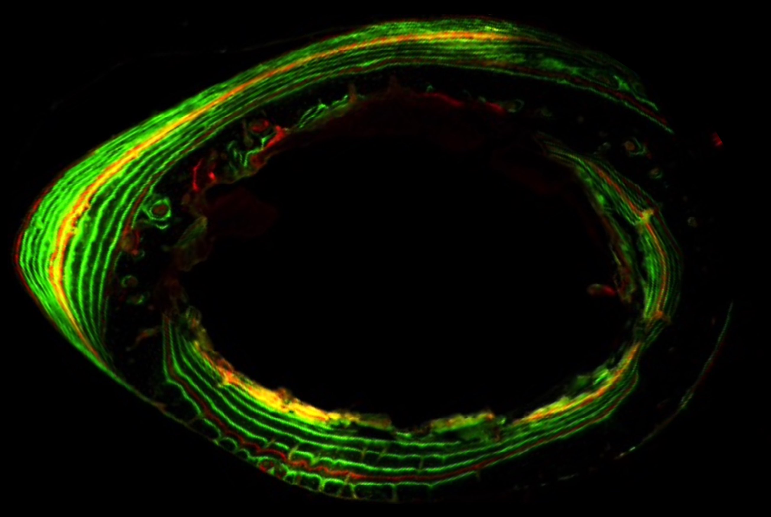 Skeletal Growth Modeling
