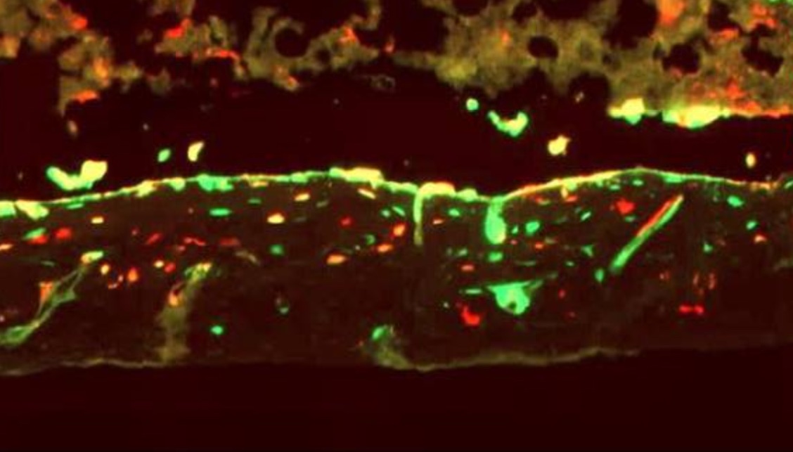 Osteogenesis Imperfecta Research