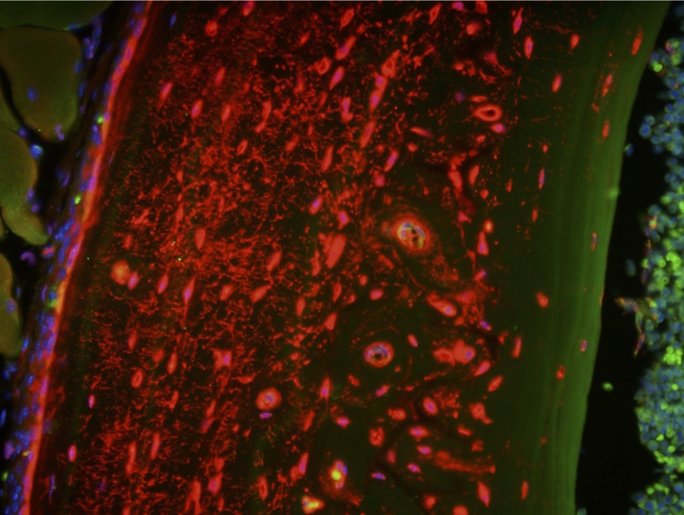 Bone Mechanical Loading